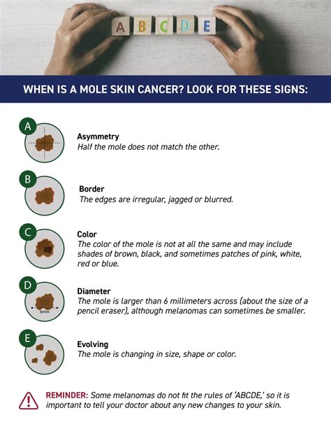 Know The Abcs Of Skin Cancer To Help Find Cancer Early Uprise Health