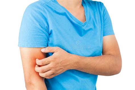 Itching Stock Photo Image Of Itch Disease Health Allergy 76785378