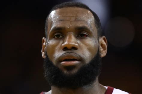 Lebron James Left Eye Looks Very Red And Gross
