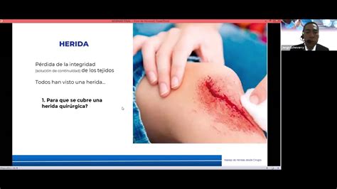 Seminario Web Manejo de Heridas desde Salas de Cirugía YouTube