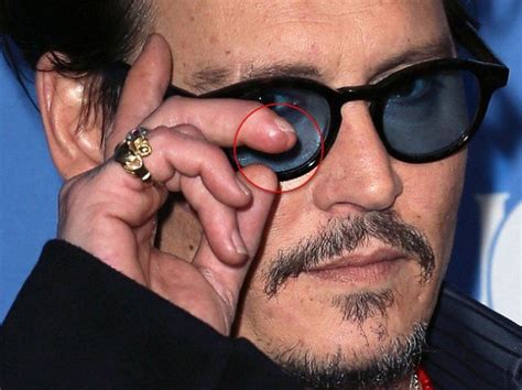 Johnny Depp Alleges Amber Heard Threw Vodka Leading To Severed Finger