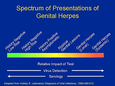 Ppt Viral Stds Genital Herpes And Warts Powerpoint Presentation Hot