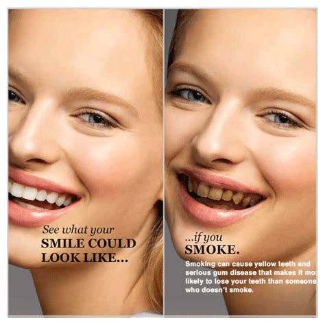 these are your teeth these are your teeth on smokes benco dental