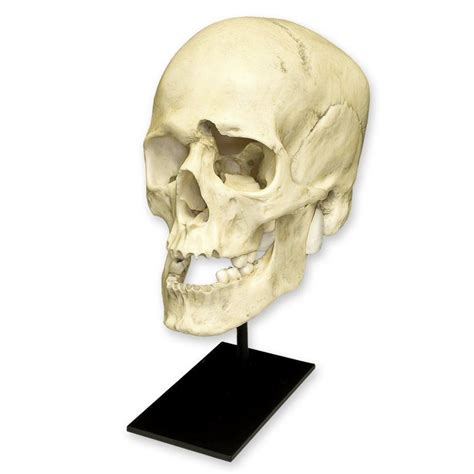 Replica Human Male With A 32 Caliber Gunshot Wound Skull For Sale