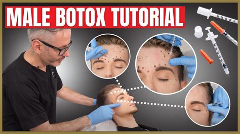 Botox Tutorial For Men Botox Injection Patterns Forehead