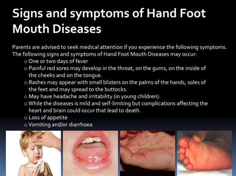 Hand Foot And Mouth Disease Adults How Long Does It Last
