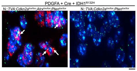 Idh1 R132h Gliomas With Atrx Loss Display An Alt Phenotype