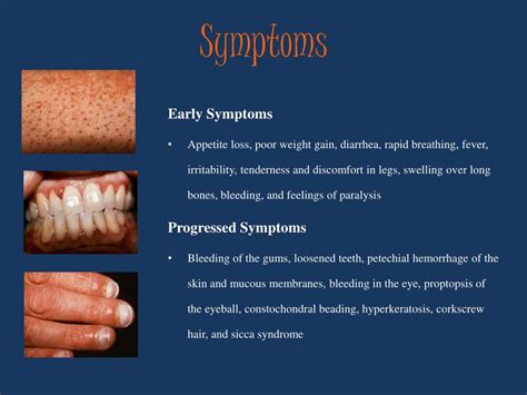 Scurvy Causes Symptoms Diagnosis Treatment Prevention