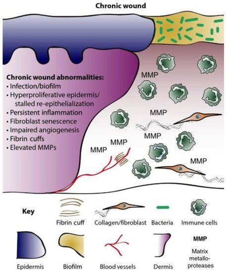 Chronic Wounds—formation And Antimicrobial Resistance Amr