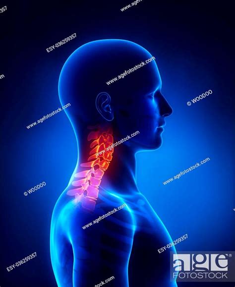 Cervical Spine Lateral View Stock Photo Picture And Low Budget
