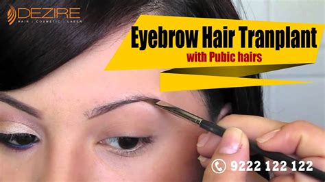 Eyebrow Hair Transplant With Pubic Hairs At Dezire Clinic Pune India