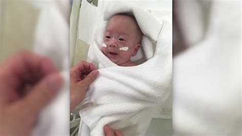 Worlds Smallest Baby Goes Home After Months Of Treatment At Japan