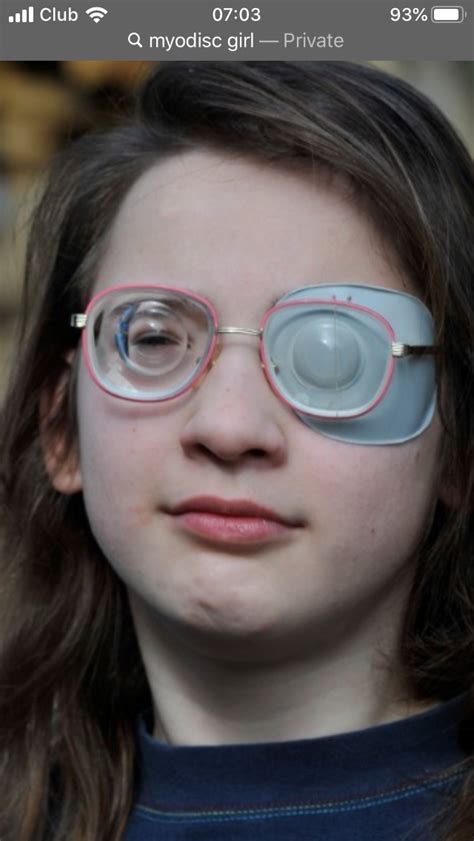 Pin By Atiger On Oči In 2021 Eye Wear Glasses Amputee Model Eyepatch