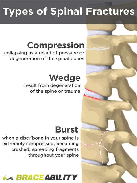 What Does It Mean If Ive Been Diagnosed With A T12 Or L1 Vertebral