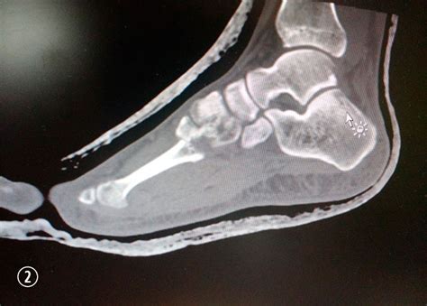Simple Science: How to Make a Volcano with Kids