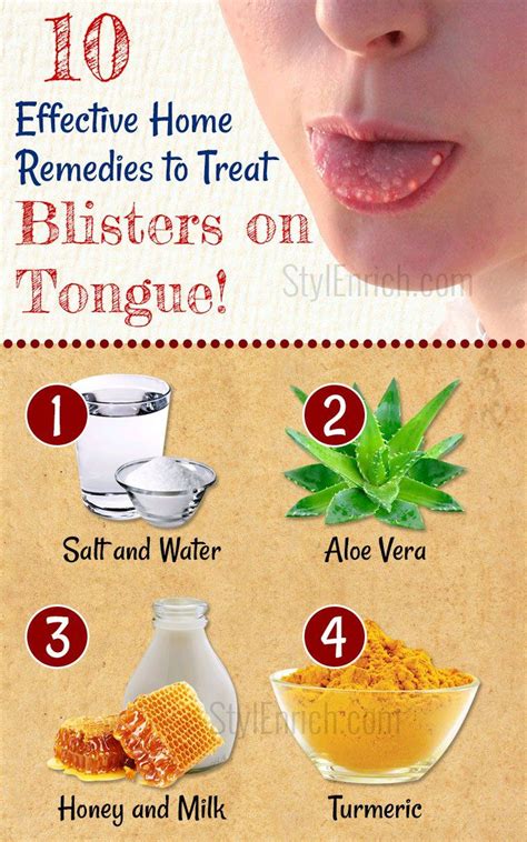 Canker Sore Infection Home Remedies Home And Garden Reference