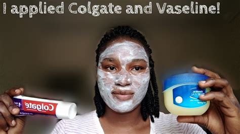 I Applied Colgate Toothpaste And Vaseline On My Face And This Happened