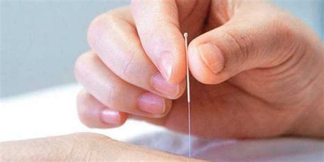 acupuncture for infertility best acupuncture hamilton nz