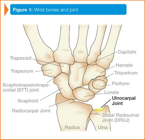 Ulnar Wrist Bone