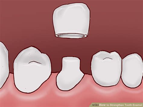 If your tooth enamel is beyond repair, then you will need to consult your dentist about having veneers or crowns fitted. 3 Ways to Strengthen Tooth Enamel - wikiHow
