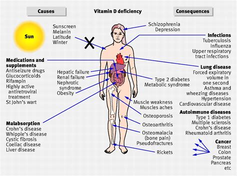 deficiency of sunlight and vitamin d the bmj