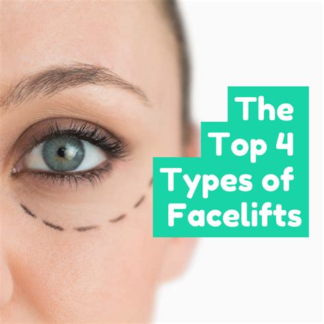 The Top 4 Types Of Facelifts Annapolis And Severna Park Md