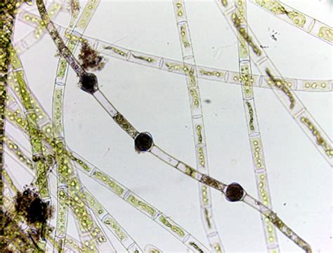 Filamentous Algae