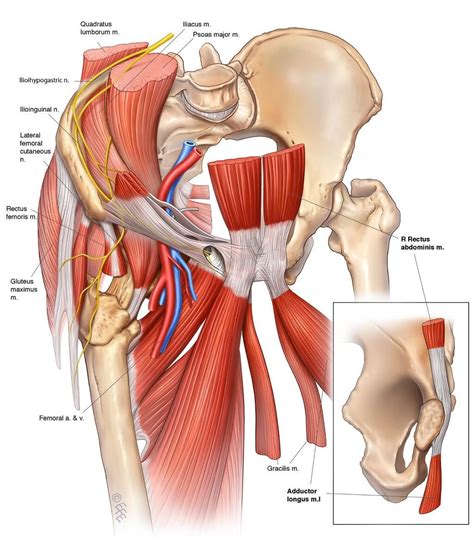 Plication of the transversalis fascia in 'shouldice hernia. Diagram of groin aponeurosis from @SSCSantry Groin Project ...
