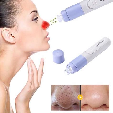 Mini Electric Facial Pore Cleanser Vacuum Blackhead Remover Acne Pimple
