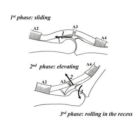 Biomechanics Of The Volar Plate Of The Proximal Interphalangeal Joint