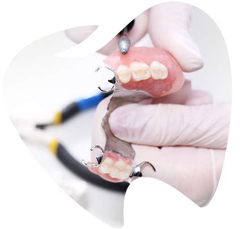 Partial Dentures Shepparton Denture Clinic