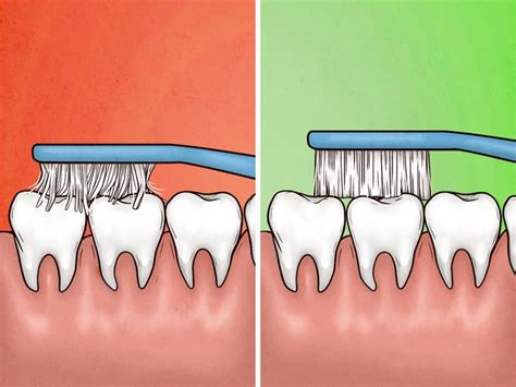 4 Signs Youre Brushing Your Teeth Too Hard And 4 Ways You Can Fix It