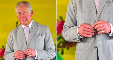 King Charles Sausage Fingers Spark Health Concerns