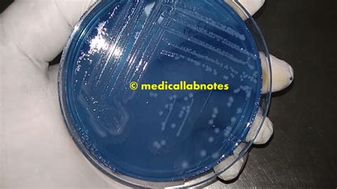 Cled Agar Introduction Composition Principle Preparation Testing