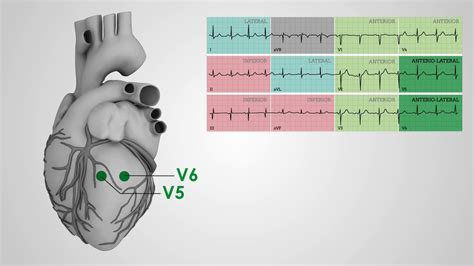 Electrical Vectors 12 Lead Ecg Placement Around The