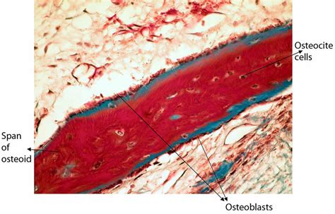 Detail Image Of A Span Of Osteoid Tm Stain ×400 Download