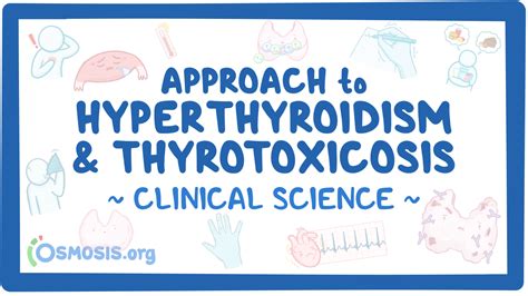 Approach To Hyperthyroidism And Thyrotoxicosis Clinical Sciences