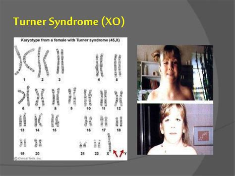 PPT H Uman Chromosome And Chromosome Behavior PowerPoint Presentation