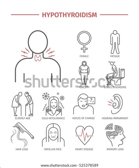 Hyperthyroidism Symptoms Treatment Line Icons Set Stock Vector Royalty