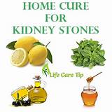 Photos of Home Remedies To Pass A Kidney Stone Quickly
