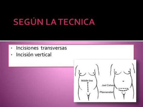 Cesarea Trans Peritoneal Cstp