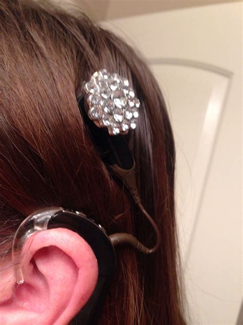 Rhinestone Button Cochlear Implant Decoration Cochlear Implant Hearing Implants