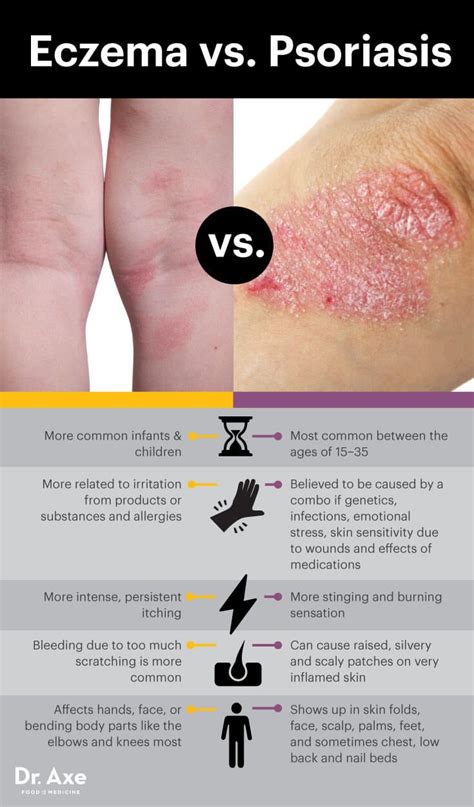 Dermatologists Often Fail To Treat These Root Causes Of Eczema Med