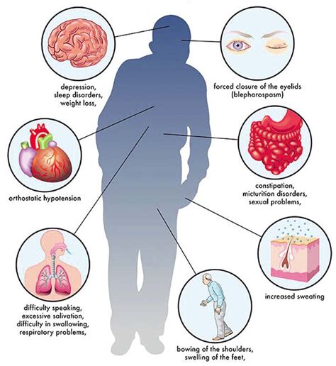 Parkinsons Disease Study Estimates 1 In 2 Women And 1 In 3 Men Set