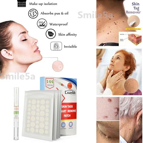 144pcs Skin Tag Acne Patch Hydrocolloid Acneandskin Tag Invisible Remover