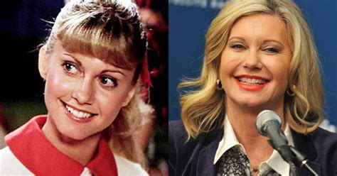 Olivia Newton John Now With Plastic Surgery Celebs Aging Then And