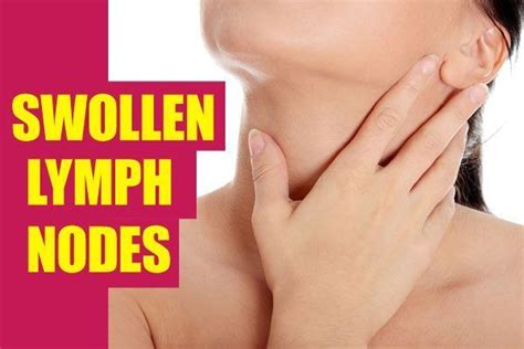 Home Remedies For Swollen Lymph Nodes Top 10 Home Remedies Swollen