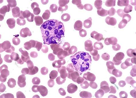 ماذا تعني Neutrophils في تحليل الدم