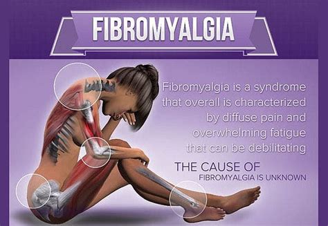 How Do You Make Fibromyalgia An Invisible Disease Visible Palos