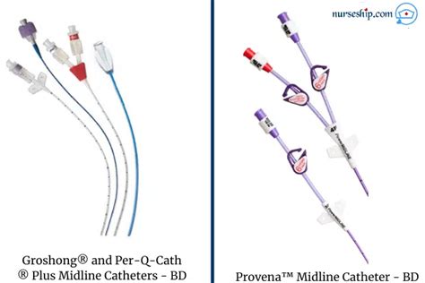 Midline Catheter Vs Peripherally Inserted Central Catheters Picc